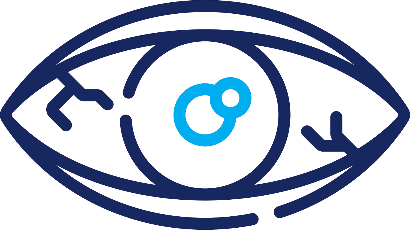 chicago glaucoma consultants